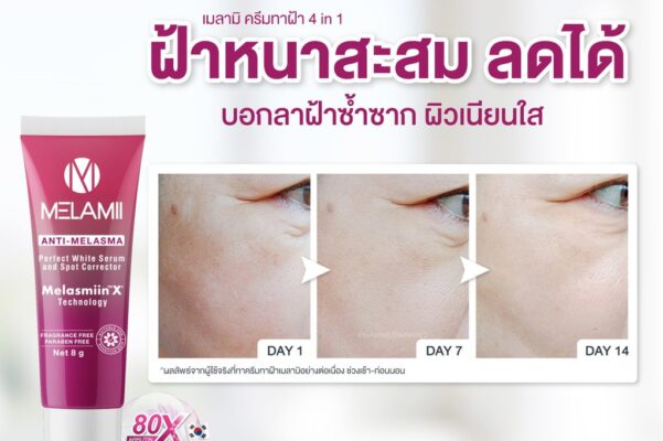 Kem trị nám Melamii Anti-Melasma