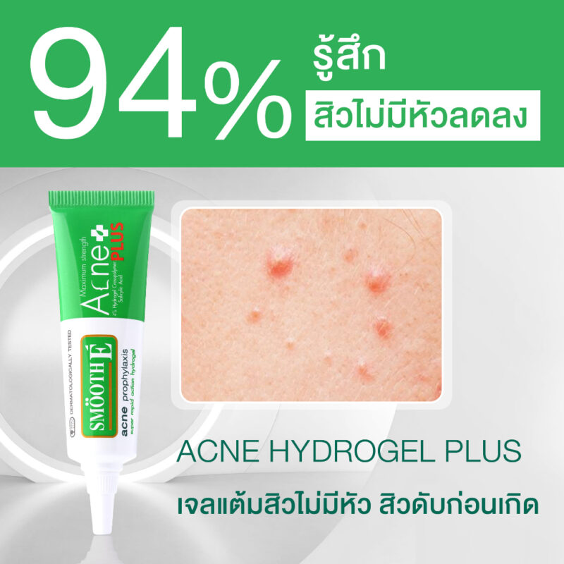 kem trị mụn Thái Lan Smooth E Acne Hydrogel Plus